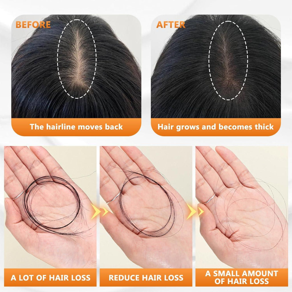 Hair Loss Treatment Shampoo 100ml